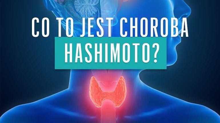 Choroba Hashimoto - just be fit