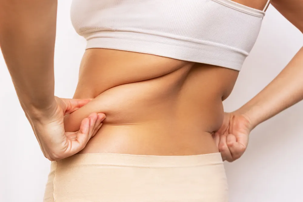 ciało kobiety z nadmiarem tkanki tłuszczowej