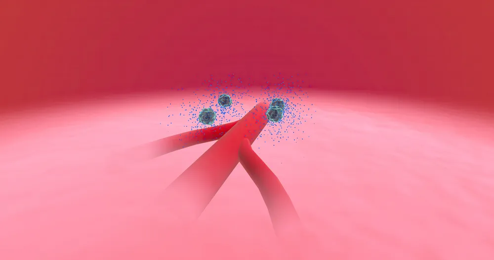 uwalnianie histaminy i obrzęk naczyniowy