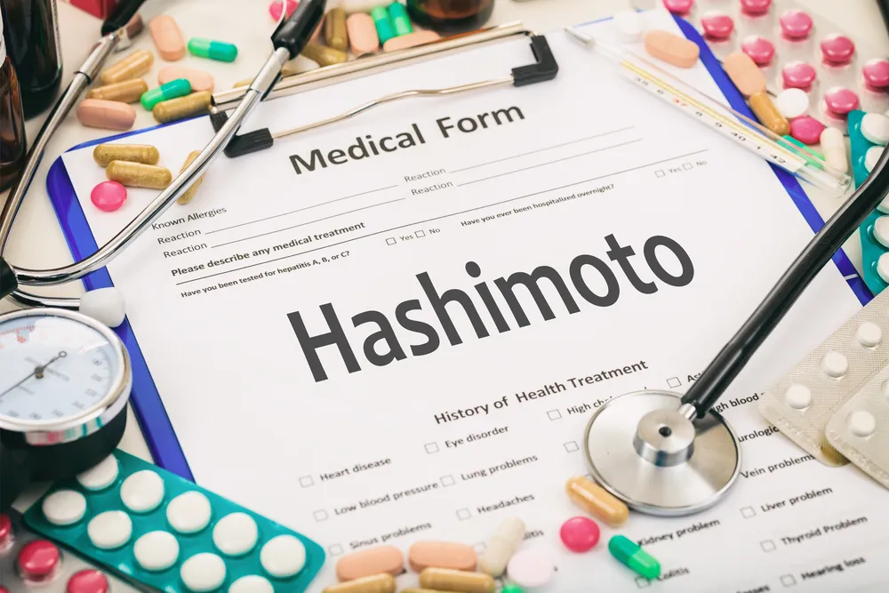 hashimoto co to jest za choroba i jak ją leczyć